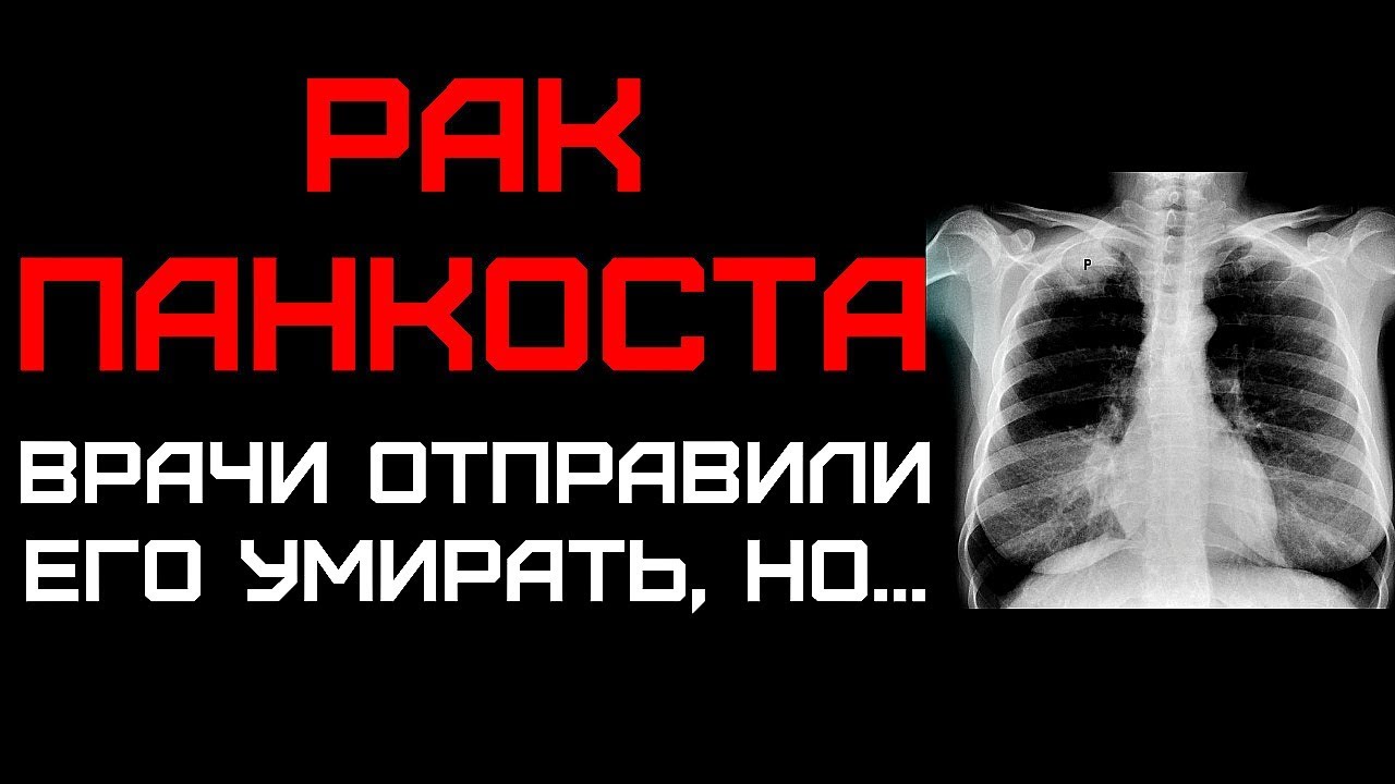Рак Панкоста - Как врачи чуть не отправили Его на тот свет. История ...