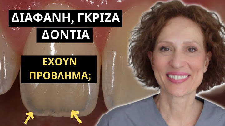 Γιατί τα δόντια μου είναι ΔΙΑΦΑΝΗ; Πώς διορθώνονται;