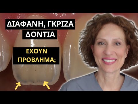 Βίντεο: Γιατί τα δόντια μου βγάζουν άκρα;