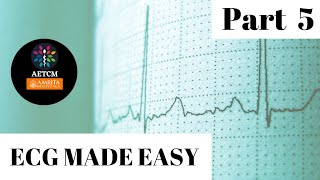 ECG MADE EASY || Part 5 || Bundle branch blocks
