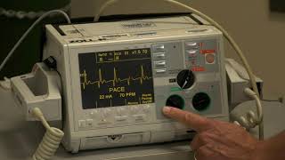 How To Do Transcutaneous Pacing in an Adult | MSD Manual