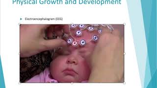 1 Infancy Ch3