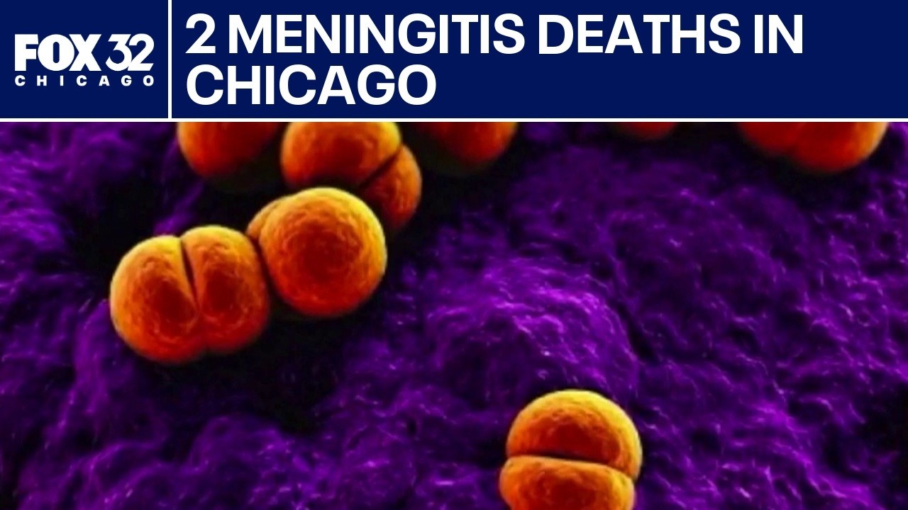 2 meningitis deaths reported in Chicago this month