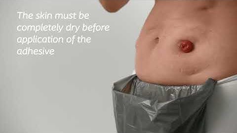 SenSura® Mio Convex 1 piece open (How To Use Video)