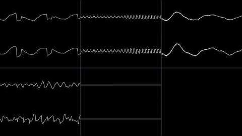 Space Quest III - Title [MT-32] (Oscilloscope View)