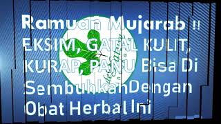 obat gatal Jamur ampuh di apotik | Jual Obat Apotik Di China