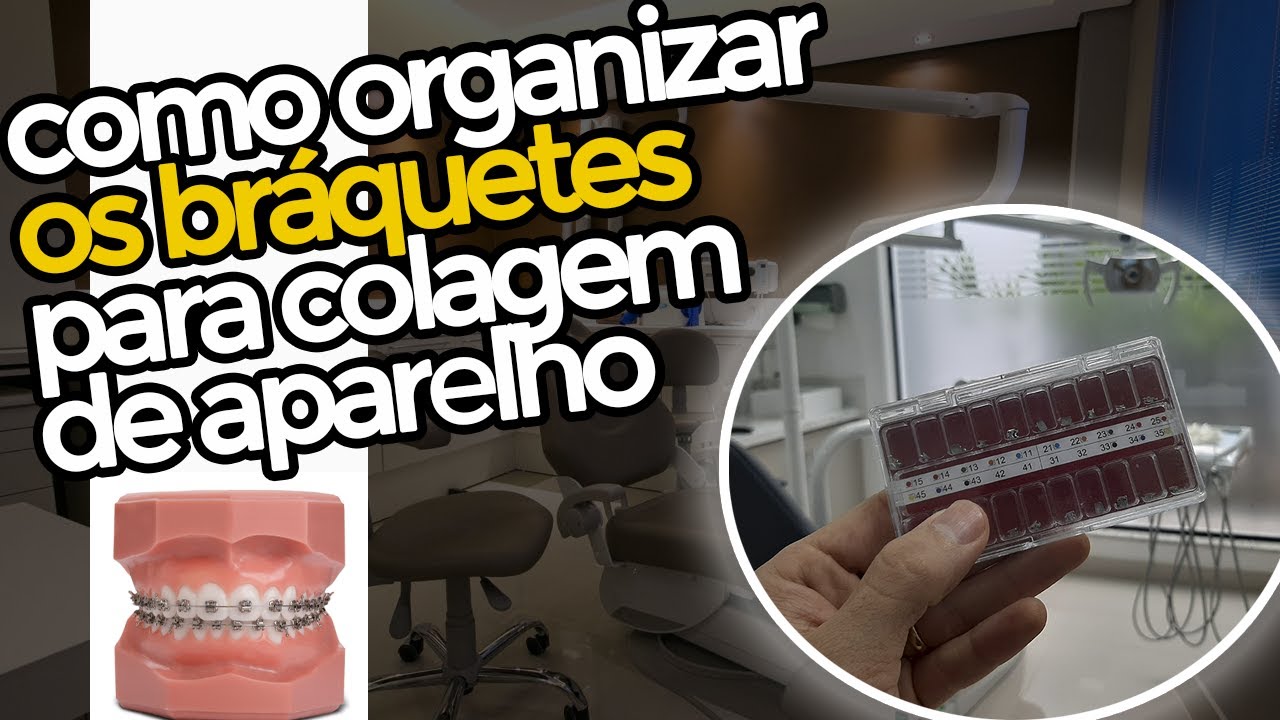 COMO ORGANIZAR OS BRÁQUETES PARA COLAGEM - ASB TOTAL