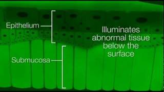 Oral Cancer Screening Velscope At Ora Oral Surgery, Sleep Disorder Implant Studio