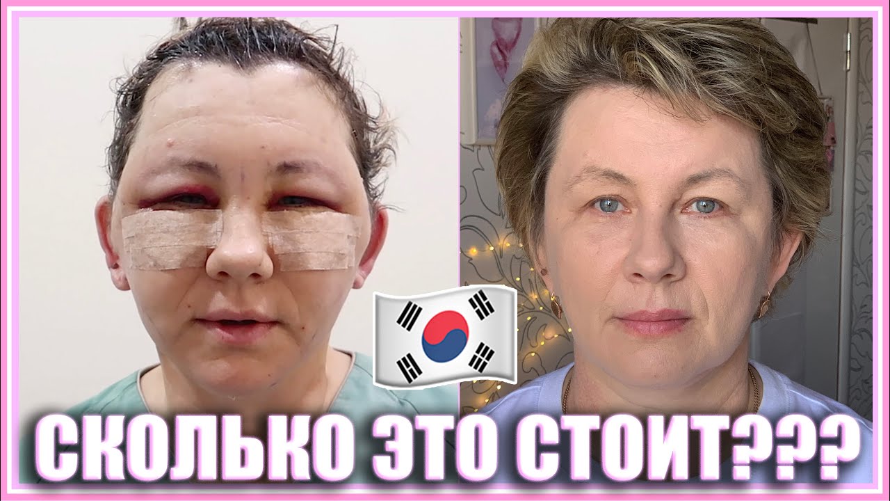 СКОЛЬКО ЭТО СТОИТ? Все, что вы хотели знать о нашей ПЛАСТИЧЕСКОЙ ...