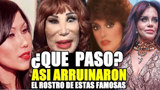 DE LYN MAY A LUCIA MENDEZ!  ASI ENGAÑARON A ESTAS ACTRICES Y CAMBIARON SU ROSTRO RADICALMENTE
