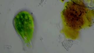 Unknown ciliate
