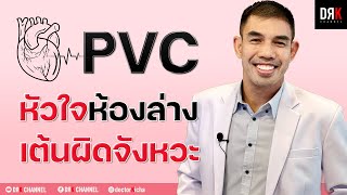 PVC คืออะไร อันตรายหรือไม่ - Doctor Kitcha #หัวใจห้องล่างเต้นผิดจังหวะ