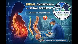 13. Spinal Anaesthesia for Spinal Deformity | Obstetric Anaesthesia | Anaesthesia Review Hub
