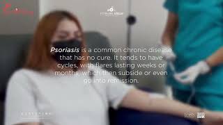 Stem Cell Therapy for Psoriasis in Guadalajara, Mexico: Inspiring 6-Session Relief