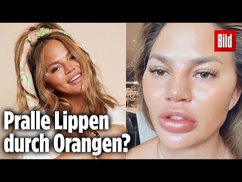 Video: Model Chrissy Teigen Erklärt, Warum Ihre Lippen Plötzlich Wie Knödel Aussahen