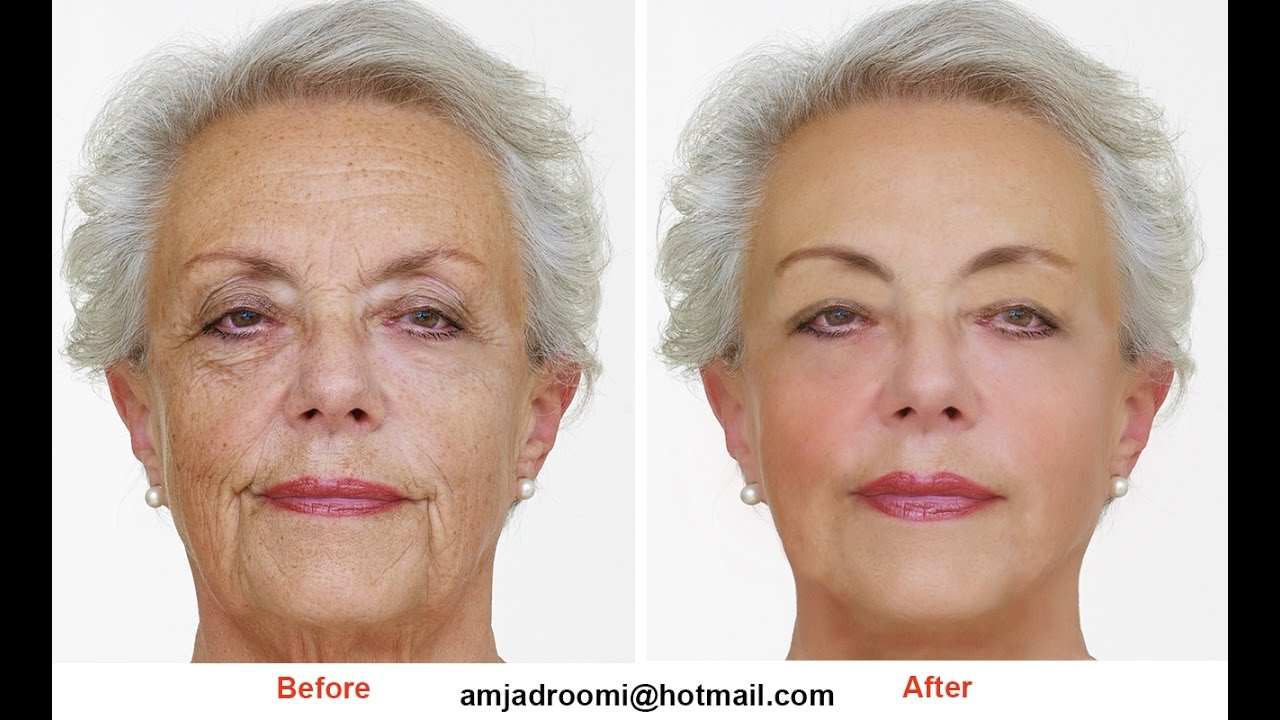 Adobe Photoshop 7 Grain Surgery Filter Adobe Photoshop 7 Grain Surgery Filter