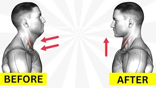 Say Hello to a Defined Jawline: Best Face Exercises to Get Rid of Double Chin
