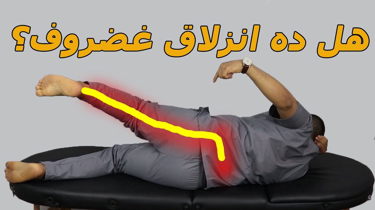 الفرق بين انزلاق الغضروف ومتلازمة العضلة الكمثرية والم اسفل الظهر,ازاى اعرف ان عندي انزلاق غضروفي؟؟