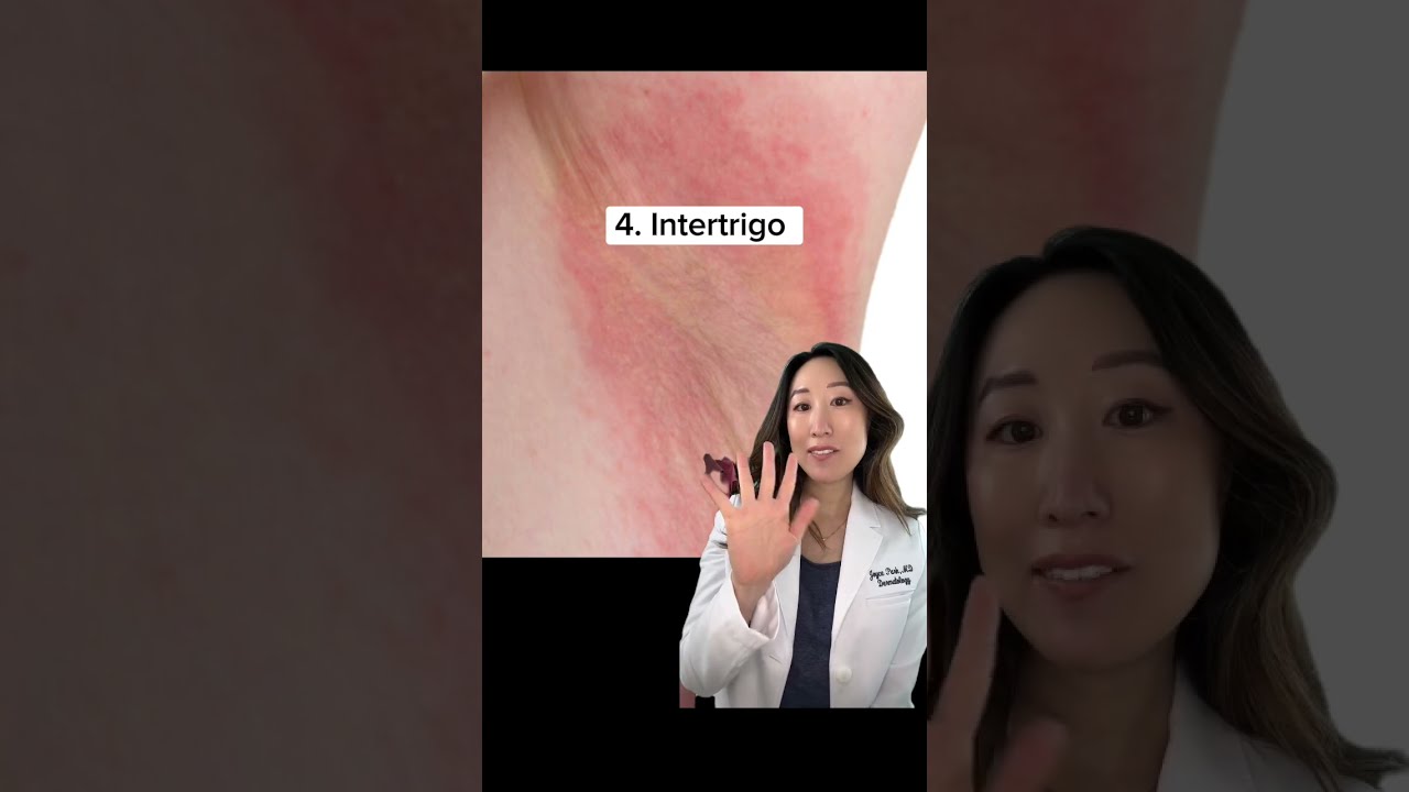 Top 10 Ways To Use Hibiclens For Common Skin Issues Dermatologist Tips 