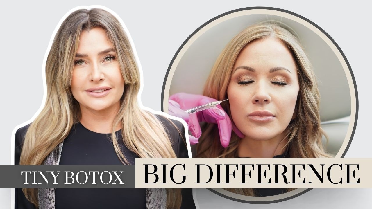 Prevent Wrinkles Before They Show With Micro Botox