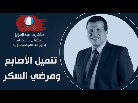 هل يوجد علاقة بين تنميل الأصابع و مرضي السكر وما هو العلاج