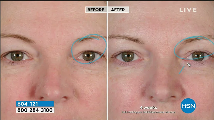 NassifMD Peri Orbital Eye Complex Duo