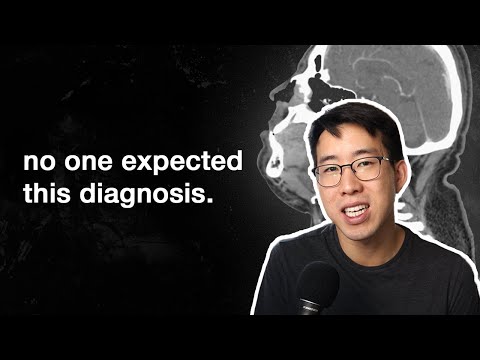 One Detail Completely Changed This Case (An Unexpected Outcome)