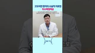 고도비만 환자의 수술적 치료법 위소매절제술!? #고도비만 #위소매절제술 #고도비만수술