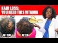 Hair loss this vitamin  can save your hair