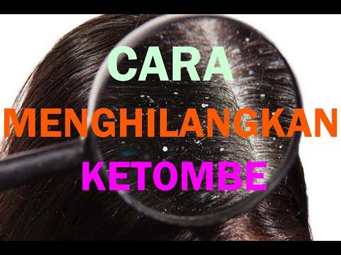 Pesona Dewasa: Cara Menghilangkan Ketombe