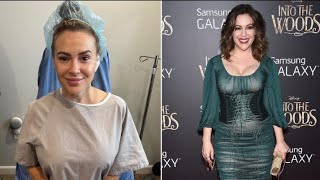 Celebrity Alyssa Milano REMOVES breast implants as she 'lets go' of 'body that was sexualized and abused Wealth
