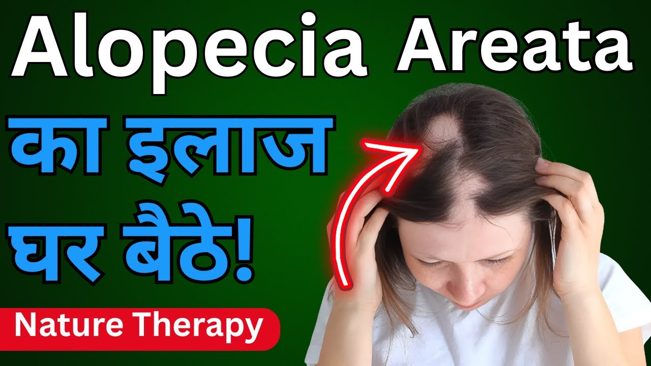 Alopecia Areata Treatment at Home | Nature Therapy + Ayurveda Approach