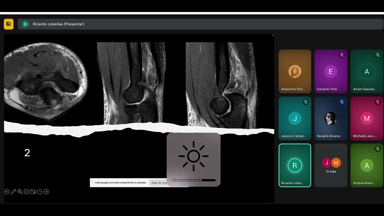 practico Codo  04-11-25   Dr Cobeñas