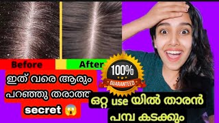 ഒറ്റ useയിൽ 100 result/വെറും 2 സാധനങ്ങൾ മാത്രംhow to remove dandruff naturally at homemalayaliyoutub