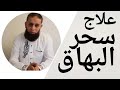 علاج سحر البهاق علاج البهاق علاج البرص