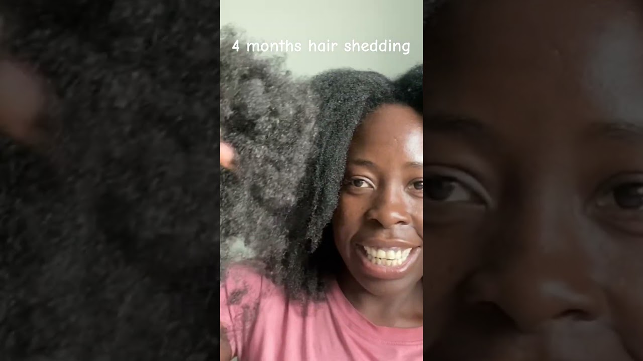 4 months hair shedding 