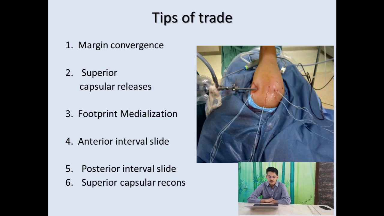 Massive Irreducible Cuff Tears(Orthopedic Surgeons) YouTube