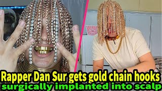 Celebrity Rapper Dan Sur gets gold chain hooks surgically implanted into scalp Profile