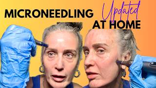 How to Do Microneedling at Home…Step by Step Guide - Dr Pen M8s
