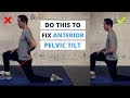 6 Minute Routine to Correct ANTERIOR Pelvic Tilt