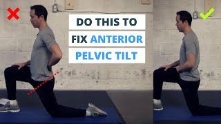 6 Minute Routine to Correct ANTERIOR Pelvic Tilt