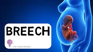 Breech