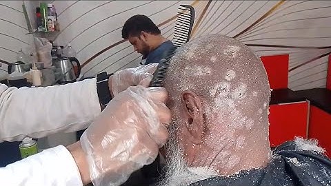 Itchy Dry Scalp Scratching Dandruff Satisfying || dandruff scratching big flakes Dollar 💵 1