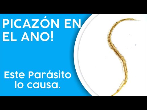 Video: ¿Por qué sigo teniendo oxiuros?