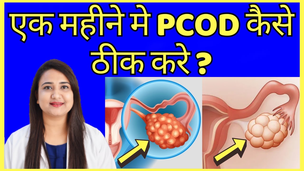 इस तरीके से सिर्फ 1 महीने में PCOD ठीक हो जाएगा | PCOD PROBLEM SOLUTION ...