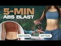 5 MIN ABS Challenge: Total Core Transformation! 💪🔥