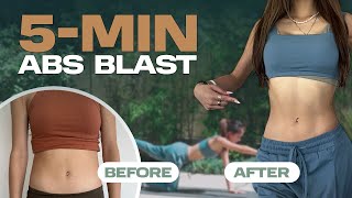 5 MIN ABS Challenge: Total Core Transformation! 💪🔥