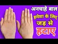 Permanent hair removal at home - without pain - हमेशा के लिए अनचाहे बाल जड़ से ख़तम - Naturally