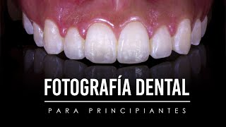 Curso de FOTOGRAFÍA DENTAL para principiantes | Dr. Rodrigo Díaz | Curso de fotografía básica screenshot 2