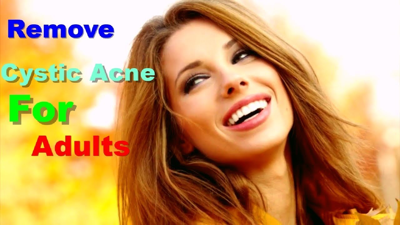 How to Get Rid of Cystic Acne For Adults Overnight | Get Rid Of Cystic ...
